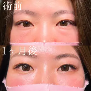 HAAB×DREAM BEAUTY CLINIC 大阪梅田院 鈴木 馨斗医師の症例