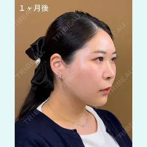 TCB東京中央美容外科 宇都宮院 岡本 卓也医師の症例