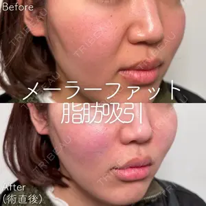 SK新宿歌舞伎町美容外科・歯科 高倉 光平医師の症例