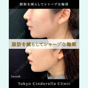 東京シンデレラ美容外科 池袋院の症例