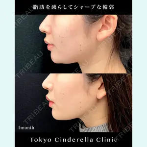 東京シンデレラ美容外科 池袋院の症例