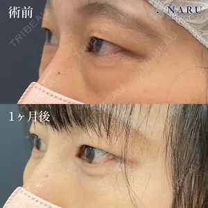 NARU Beauty Clinic 【ナルクリ】 地引 輔医師の症例