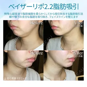 聖心美容クリニック 札幌院 前多 一彦医師の症例