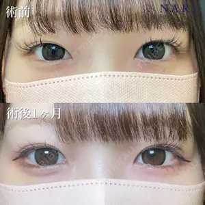 NARU Beauty Clinic 【ナルクリ】 石橋 成彦医師の症例