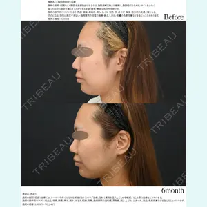 湘南美容クリニック 名古屋院 山本 高士医師の症例