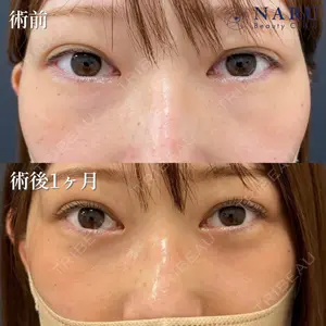 NARU Beauty Clinic 【ナルクリ】 石橋 成彦医師の症例