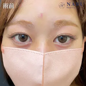 NARU Beauty Clinic 【ナルクリ】 石橋 成彦医師の症例