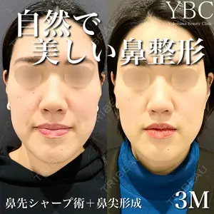 YBC横浜美容外科 池袋院の症例