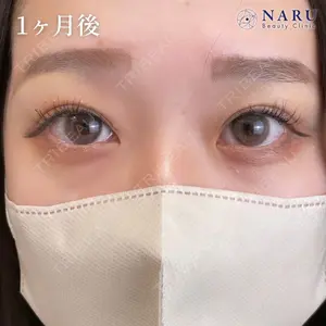 NARU Beauty Clinic 【ナルクリ】 地引 輔医師の症例