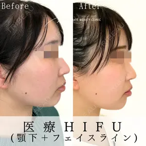 Mavie Beauty Clinic （マヴィービューティークリニック）の症例