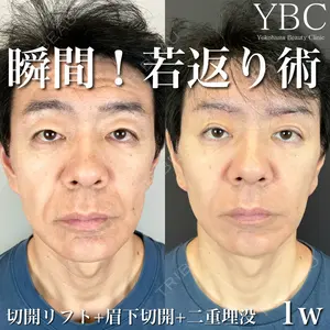 YBC横浜美容外科 大宮院 磯村 亮輔医師の症例