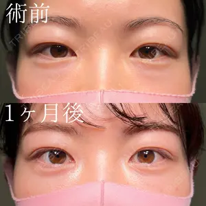 HAAB×DREAM BEAUTY CLINIC 大阪梅田院 鈴木 馨斗医師の症例