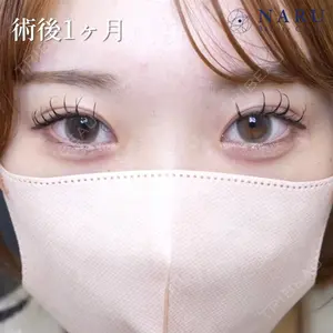 NARU Beauty Clinic 【ナルクリ】 石橋 成彦医師の症例