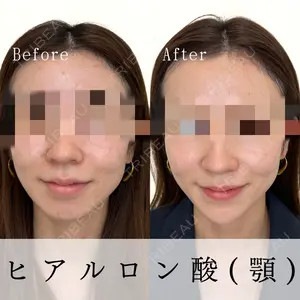 Mavie Beauty Clinic （マヴィービューティークリニック）の症例