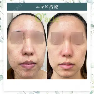 オラクル美容皮膚科 名古屋院の症例