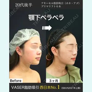 湘南美容クリニック 名古屋院 山本 高士医師の症例