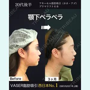 湘南美容クリニック 名古屋院 山本 高士医師の症例