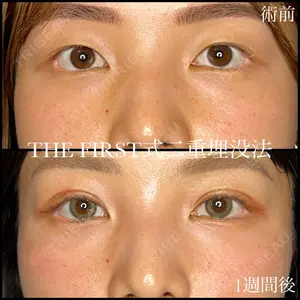 THE FIRST CLINIC 多摩センター院 惟村 公郁医師の症例