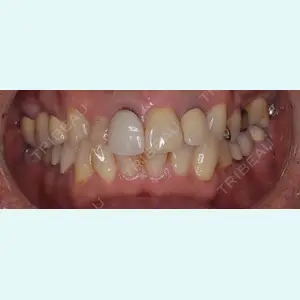 Shiny Teeth Clinic 【シャイニー ティース クリニック】 高橋 直人医師の症例
