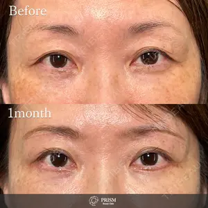 PRISM Beauty Clinic 新宿院 畑山 知輝医師の症例