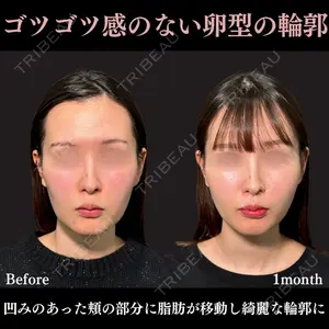 PRISM Beauty Clinic 新宿院 畑山 知輝医師の症例