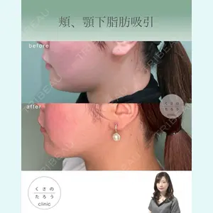 くさのたろうクリニックの症例
