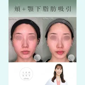 くさのたろうクリニックの症例