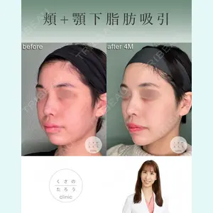 くさのたろうクリニックの症例