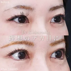 症例