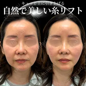 INO BEAUTY CLINICの症例