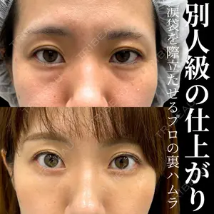 INO BEAUTY CLINICの症例