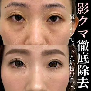 INO BEAUTY CLINICの症例