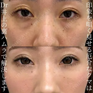 INO BEAUTY CLINICの症例