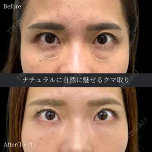 INO BEAUTY CLINICの症例