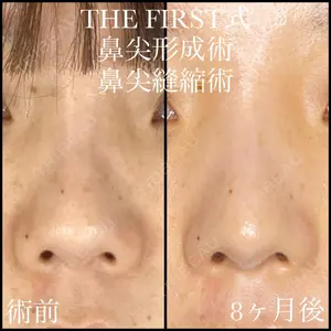 THE FIRST CLINIC 多摩センター院 惟村 公郁医師の症例