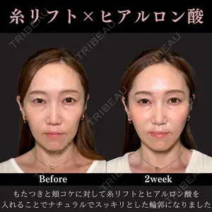 PRISM Beauty Clinic 新宿院 畑山 知輝医師の症例