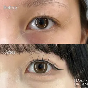 HAAB×DREAM BEAUTY CLINIC 東京本院 田中 優太医師の症例