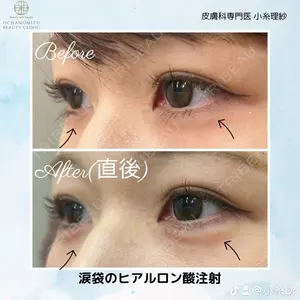 症例
