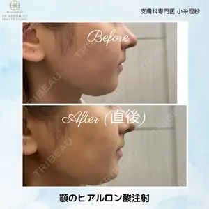 症例