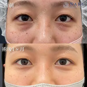 NARU Beauty Clinic 【ナルクリ】 地引 輔医師の症例