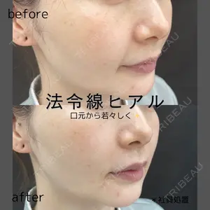 ルラ美容クリニック 仙台院 橋本 英樹医師の症例