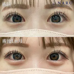 NARU Beauty Clinic 【ナルクリ】 石橋 成彦医師の症例