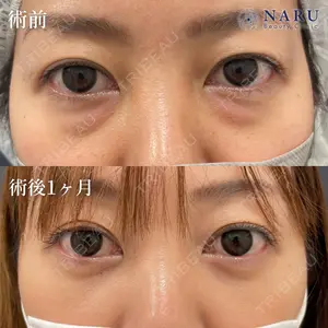 NARU Beauty Clinic 【ナルクリ】 地引 輔医師の症例