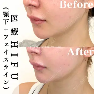 Mavie Beauty Clinic （マヴィービューティークリニック）の症例