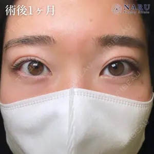 NARU Beauty Clinic 【ナルクリ】 地引 輔医師の症例