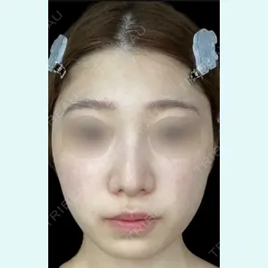YAE C5 CLINICの症例