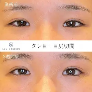 LOUIS CLINIC 二子玉川院【ルイクリニック】 小松 塁医師の症例