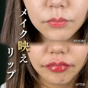 ルラ美容クリニック 千葉院の症例