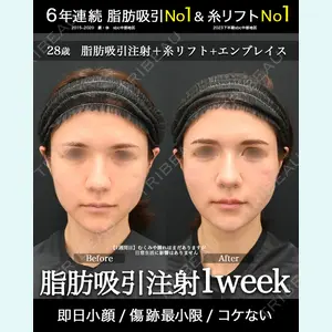 湘南美容クリニック 名古屋駅本院 高川 裕也医師の症例