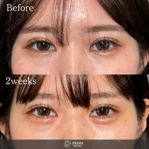 PRISM Beauty Clinic 新宿院 畑山 知輝医師の症例